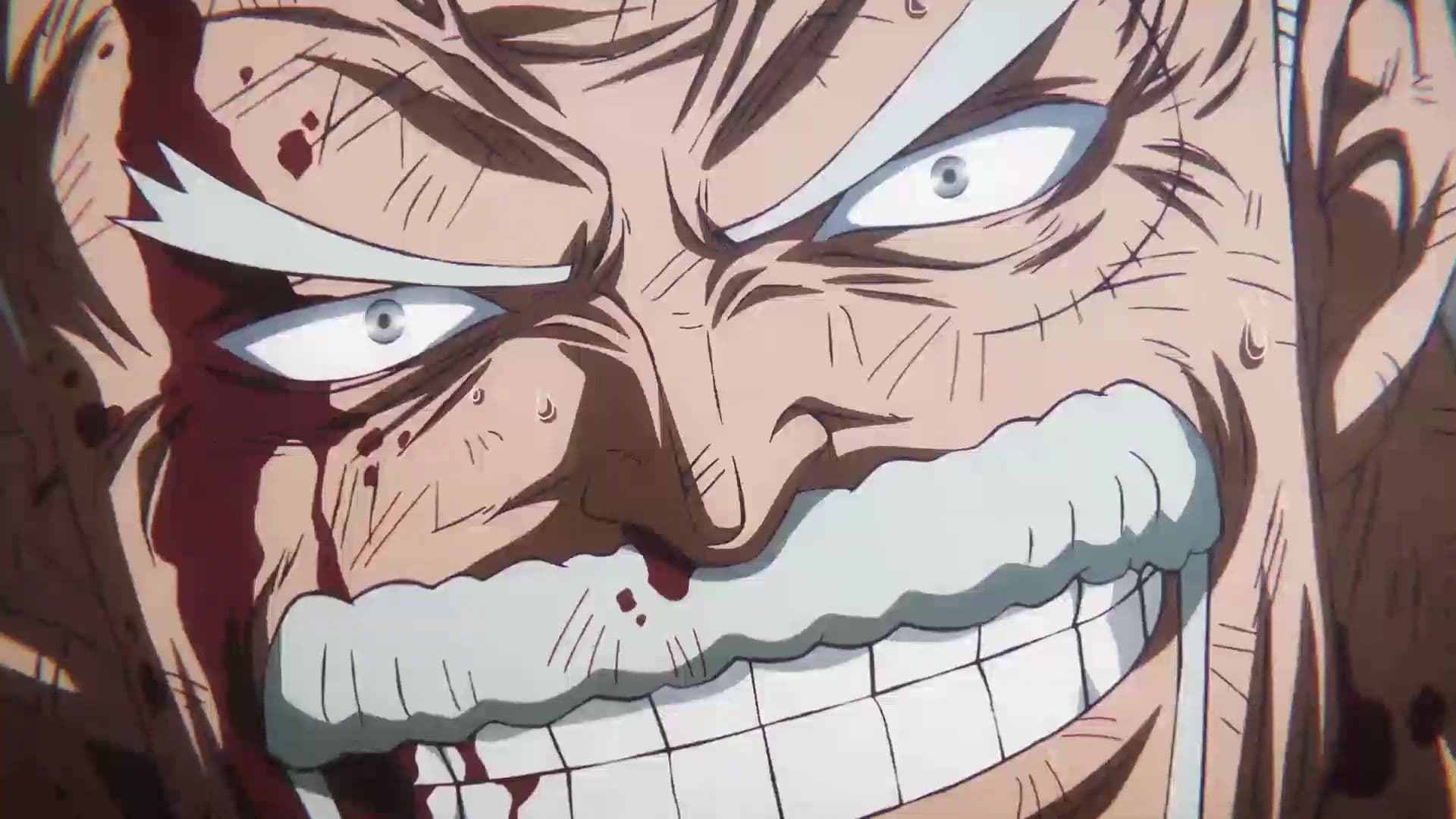 EP 1122